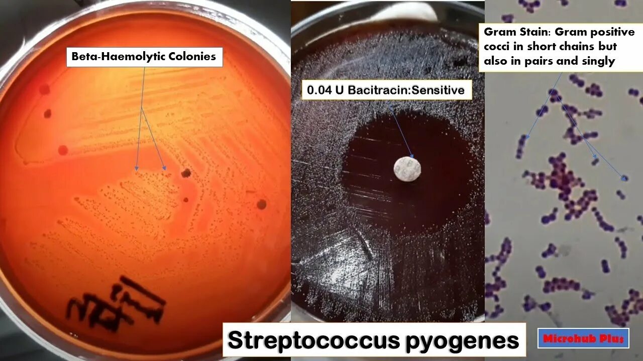 Streptococcus pyogenes на питательной среде. Стрептококки Бацитрацин тест. Тест стрептококк группы а