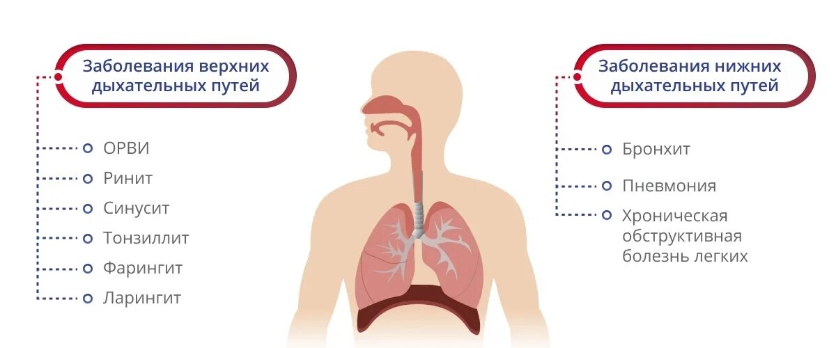 Дыхание при орви. Вирусы вызывающие заболевания верхних дыхательных путей. Синдром воспаления верхних дыхательных путей. К заболеваниям верхних дыхательных путей относят. Этиология заболеваний верхних дыхательных путей.