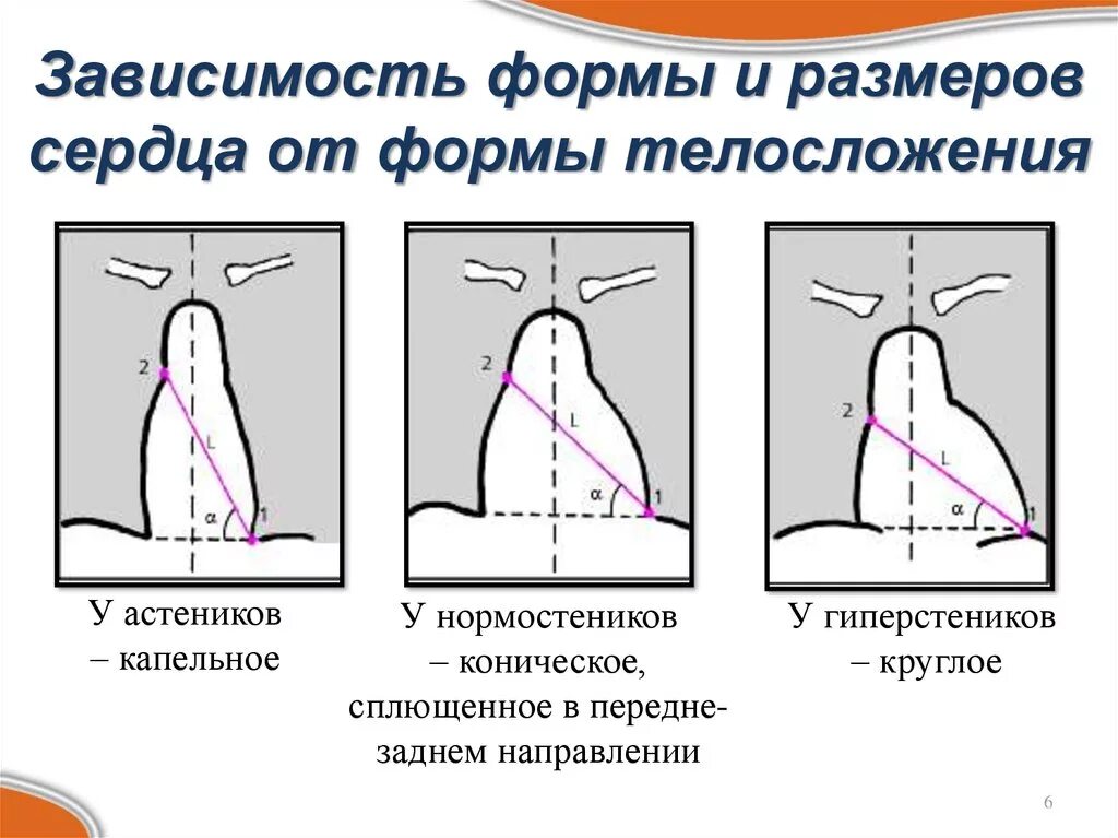 Норма форма сердца. Положение сердца в зависимости от типа телосложения. Варианты положения сердца. Типы положения сердца. Форма и положение сердца.