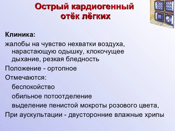 Как понять что отек легких. Отек легких презентация.
