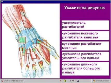 Удерживатель сухожилий