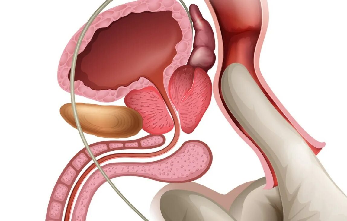 Предстательной массаж предстательной железы. Простатит массаж предстательной железы. Простата и предстательная железа. Массаж предстательной железы мужчинам. Простатита гиперплазии предстательной железы