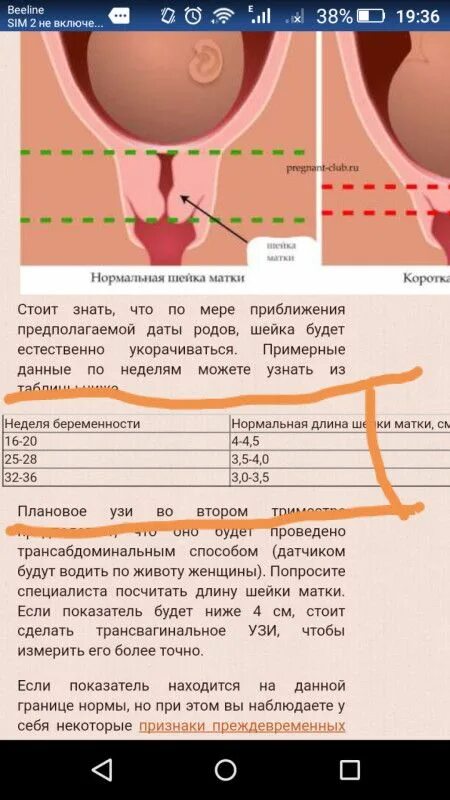 Размеры шейки по неделям. Шейка матки на 11 неделе беременности. Длина шейки матки. Расположение шейка матки при беременности. Расположение матки на 11 неделе.