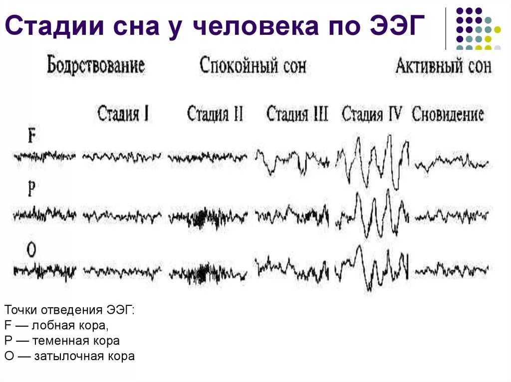 Срок ээг. Стадии сна на ЭЭГ. ЭЭГ сна ритмы. ЭЭГ-корреляты фаз сна.. Показатели ЭЭГ медленного сна.