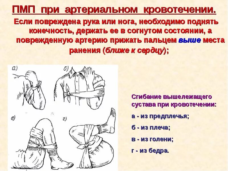 Действия при сильном кровотечении. Оказание первой помощи при артериальном кровотечении. РМП при артериальном кровотечении. Этапы оказания первой помощи при артериальном кровотечении. Оказание первой помощи при артериальном кровотечении конечности.