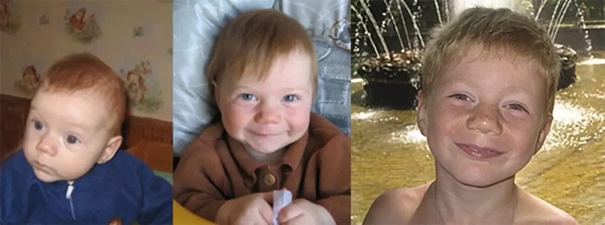 Детдомовские дети до и после. Дети которых усыновили до и после фото. Дети до и после детдома. После усыновления. Дети до и после детдома.