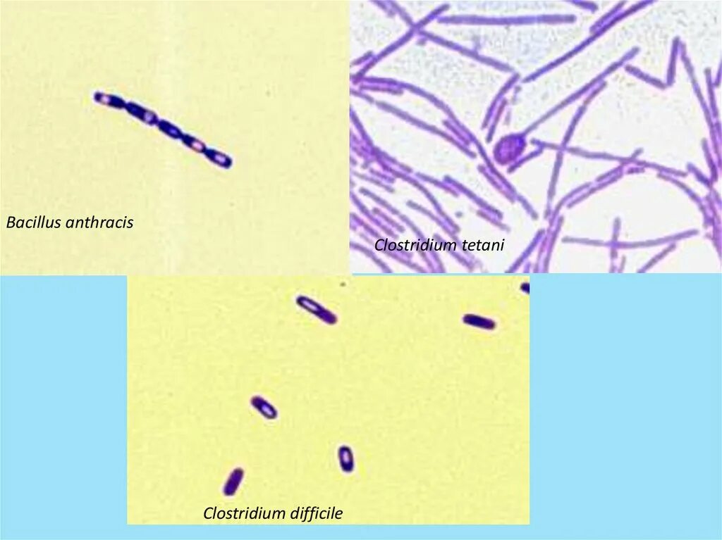 Клостридии диффициле в кале. Clostridium difficile микробиология. bacillus anthracis микроскопия. клостридиум диффициле морфология. bacillus anthracis микробиология.