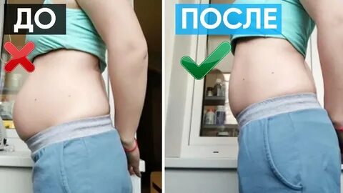 Поднятие органов