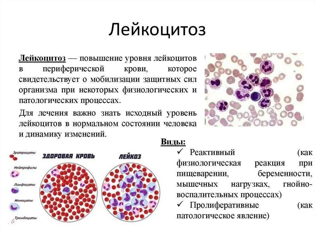 Острый лейкоцитоз крови показатели. Уменьшение содержания в крови нормальных лейкоцитов. Патология крови лейкоцитозы. Болезни при повышении лейкоцитов. Патологические клетки крови не обнаружены