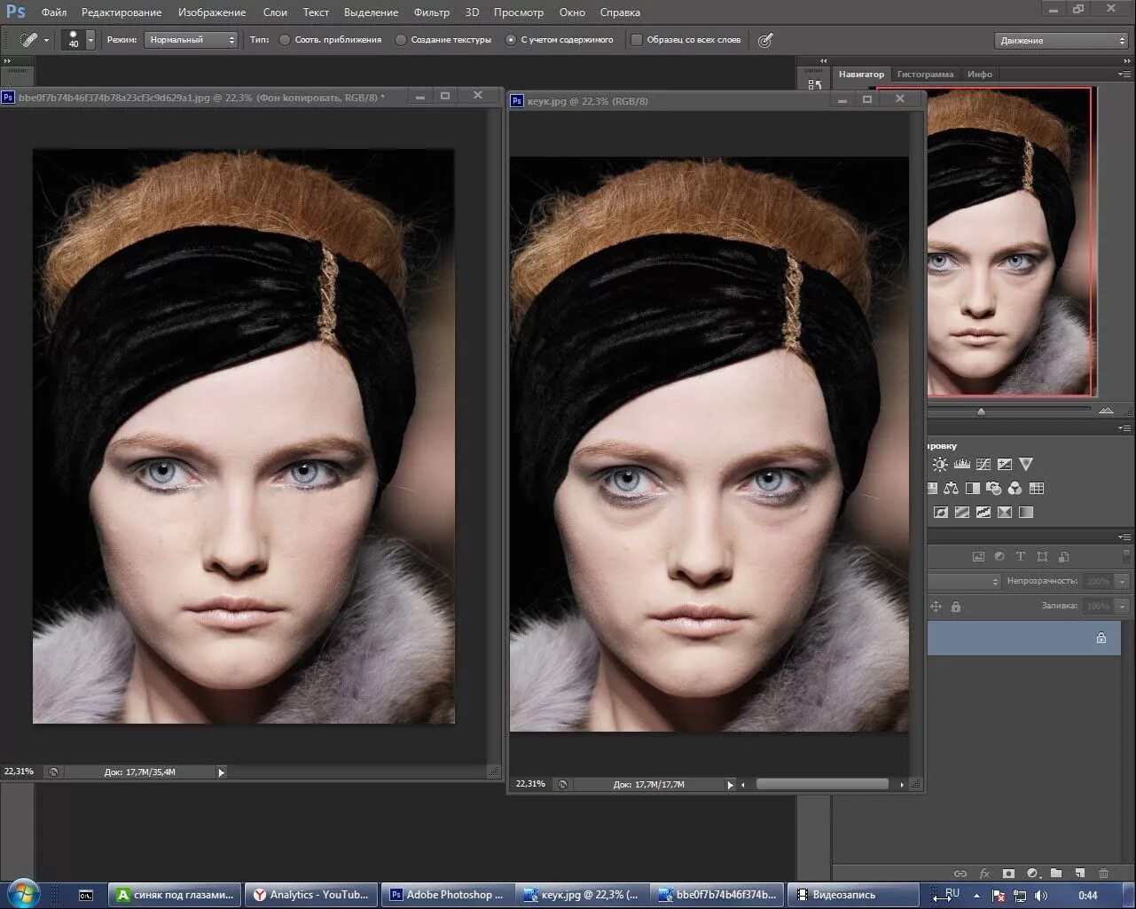 Как убрать синяки под глазами фотошоп. Как убрать синяки в фотошопе. Убрать синяки под глазами в фотошопе. Темные круги под глазами для фотошопа. Мешки под глазами для фотошопа.