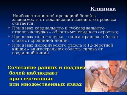 Эпигастральный инфаркт