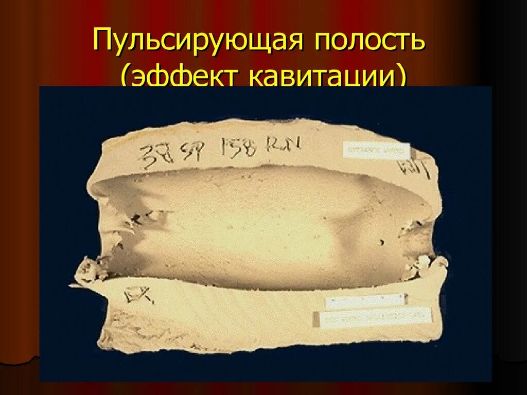 62х54. Временная полость от пули. Пульсирующая полость. Временно пульсирующая полость. Раневая баллистика.