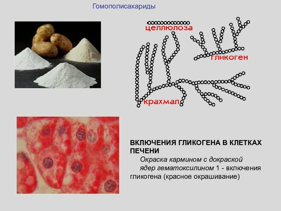 Включения гликогена в печени. Препарат гликоген в клетках печени. Накопление гликогена в печени. Включения гликогена в клетках печени.