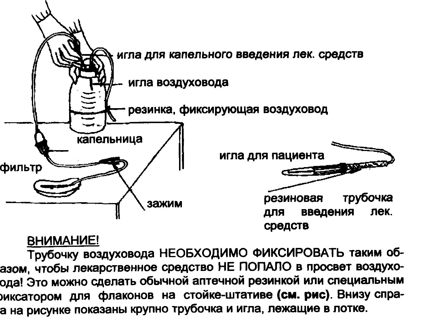 Заполнение внутривенной системы алгоритм. Схема сбора системы капельницы. Строение иглы для капельниц. Устройство системы для внутривенного капельного вливания схема. Основные части системы для внутривенных вливаний.