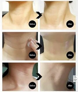Neck thread