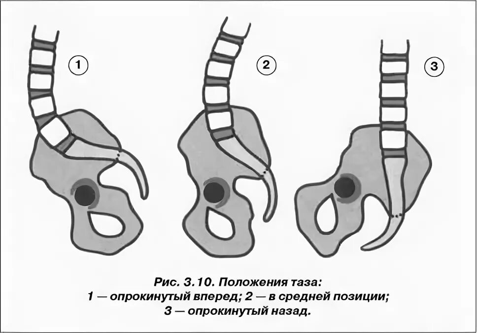Вариант 12 предмет не опрокидывается назад