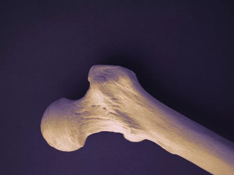 Bone mineral