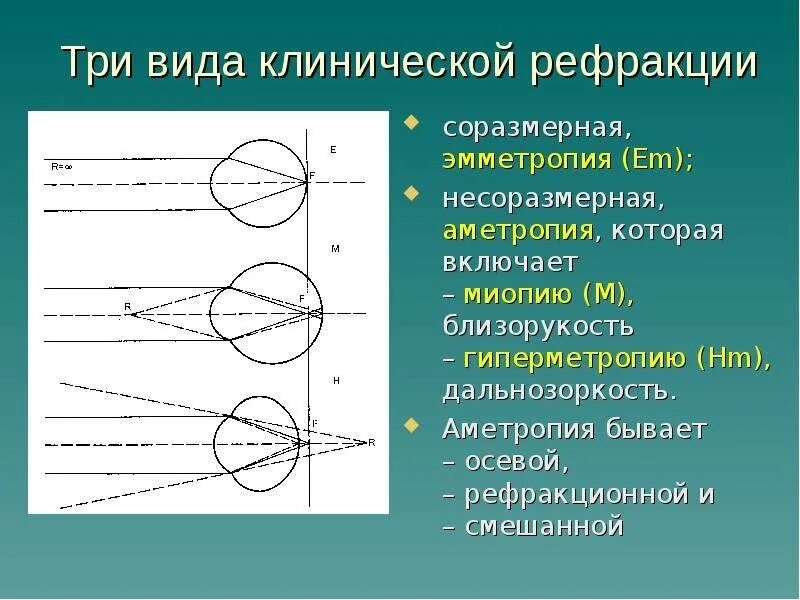 Нарушение рефракции. Нарушение рефракции