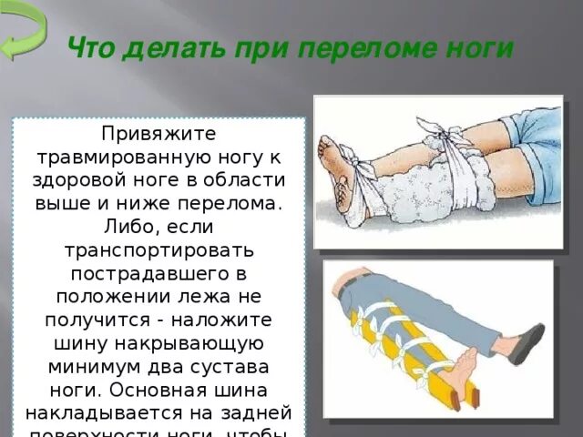 Что значит сломать ногу