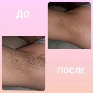 Депиляция бикини воском сам