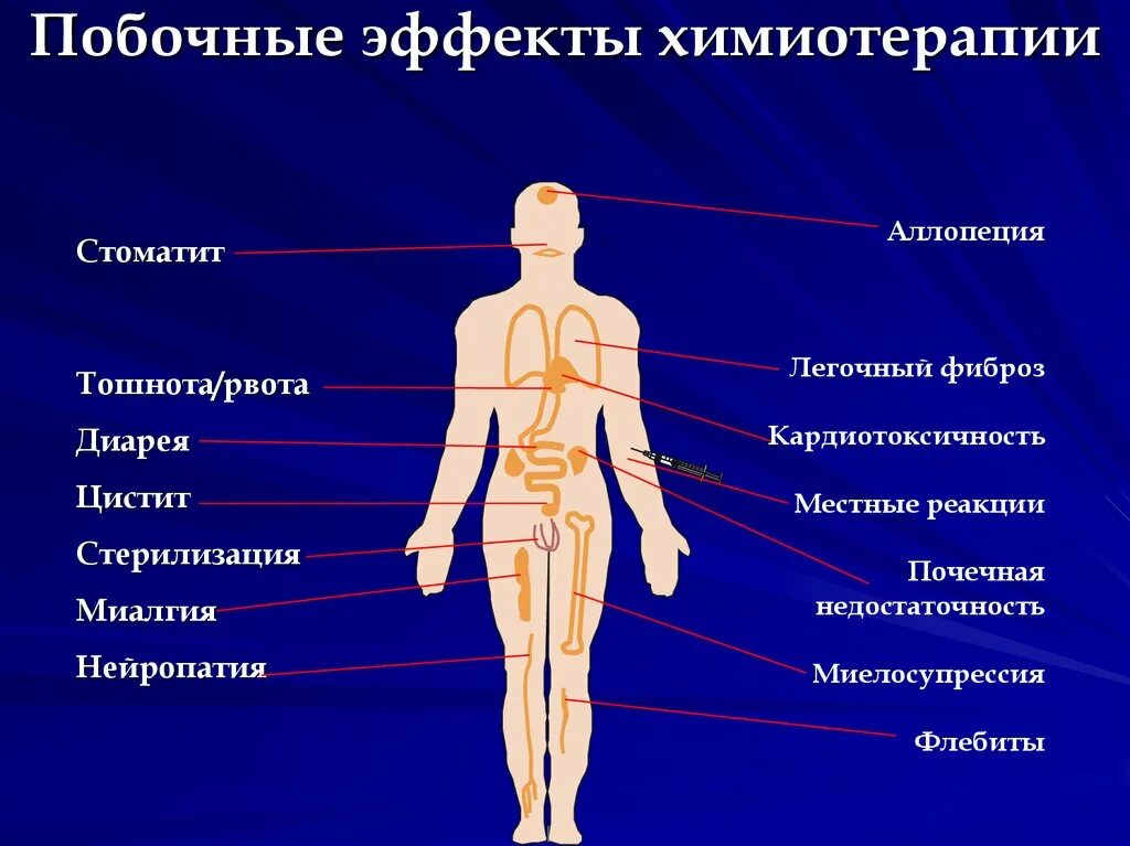 Побочные действия химиотерапии. Побочные реакции химиотерапии. Химия терапия побочные эффекты. Побочные эффекты и осложнения химиотерапии.