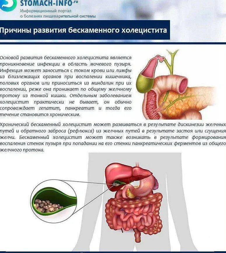 Холецистит желчнокаменная болезнь симптомы. Синдромы желчного пузыря симптомы. Холецистит воспаление желчного пузыря. Застойного желчного пузыря что это,хронического холецистита.