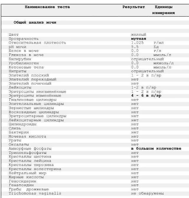 Повышена относительная плотность мочи что это значит. Анализ мочи мочевая кислота норма. общий анализ мочи единицы измерения. мочевая кислота в моче норма ммоль/л. норма мочевой кислоты в моче таблица.