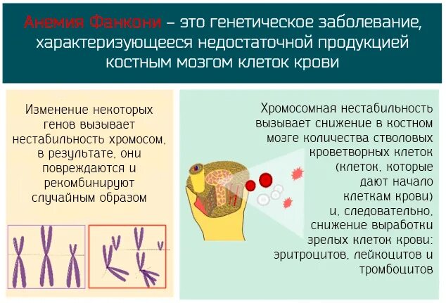 Костный мозг какие заболевания. Апластическая анемия Фанкони. Анемия Фанкони генетика. Апластическая анемия Фанкони у детей.