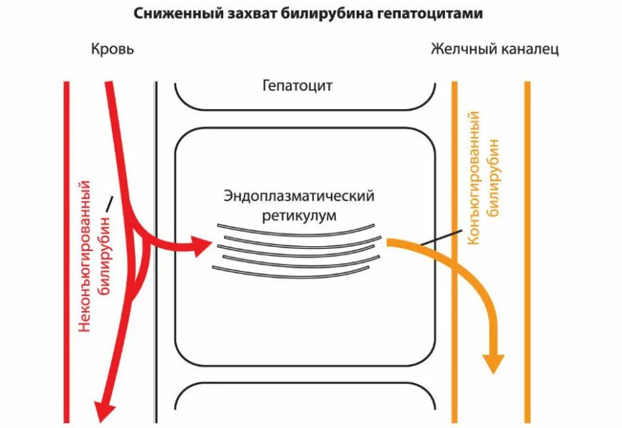 При каком билирубине жильбер. Синдром жильбера механизм развития. синдром жильбера схема наследования. синдром жильбера этиология. синдром жильбера патогенез схема.