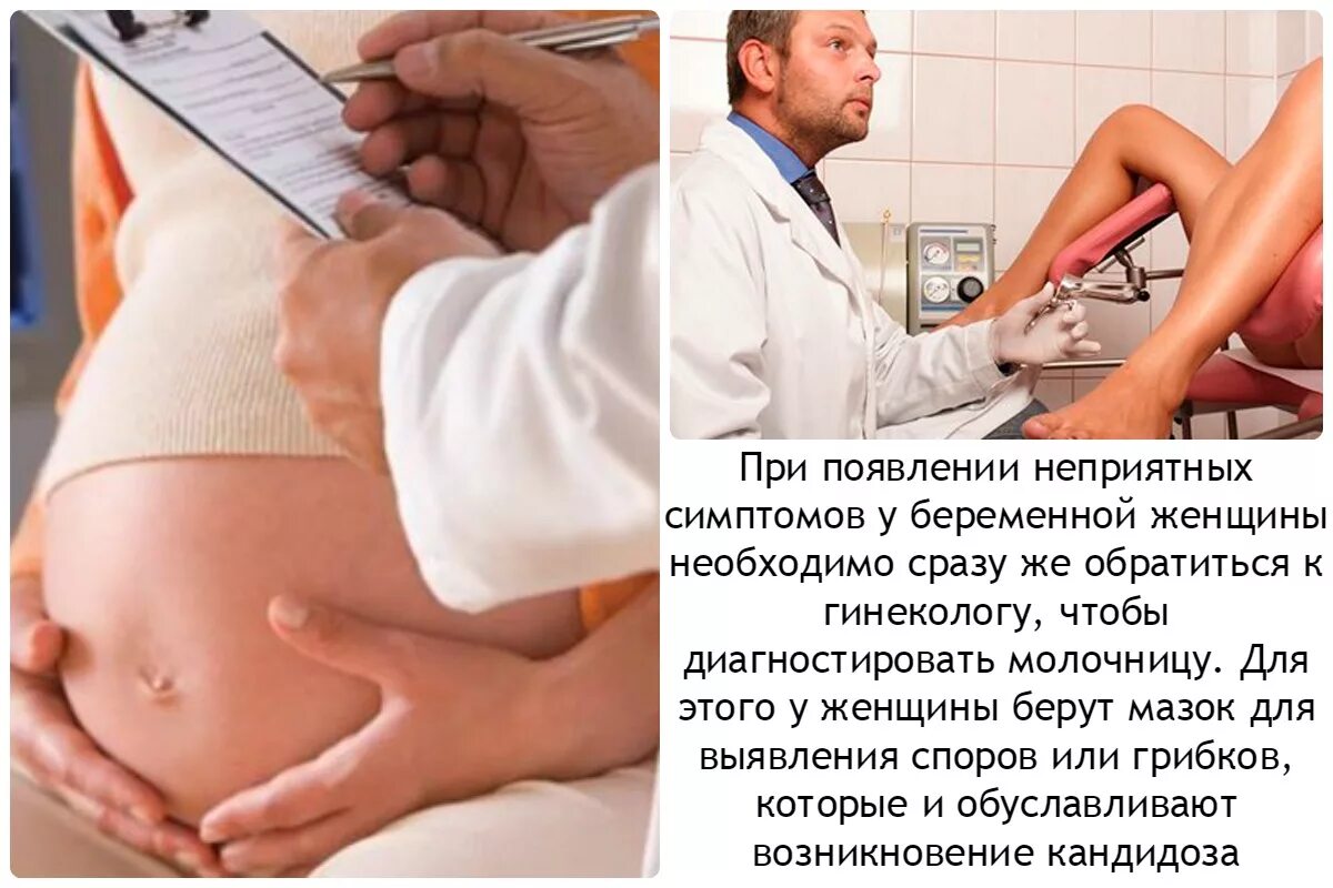 Молочница при беременносьт. Молочница при беременомт. Беременные женщины при кандидозе