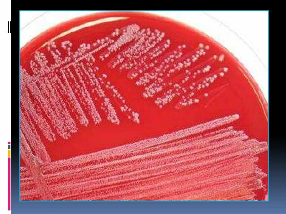 Bordetella pertussis iga. Bordetella pertussis среды. Рост b. pertussis на среде борде-Жангу. Колонии Bordetella pertussis на среде борде-Жангу. Среда борде Жангу микробиология.