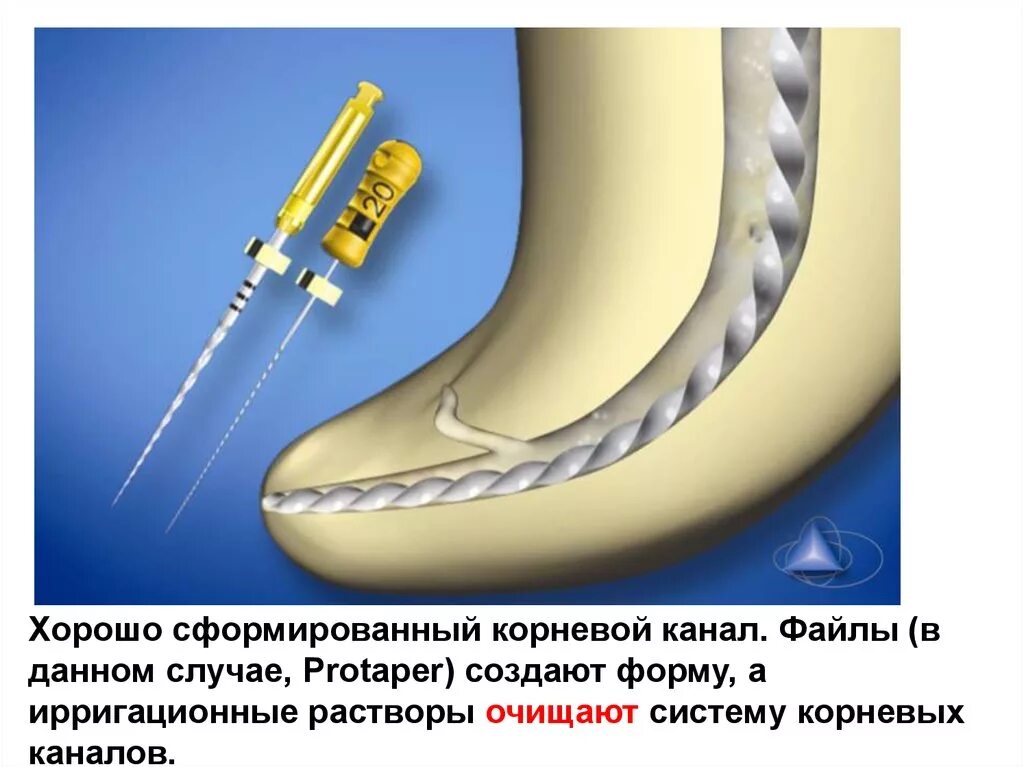 Определение корневых каналов. Растворы ирригационные корневых каналов. Ирригация системы корневых каналов. Ирригация корневого канала в стоматологии. Определение длины корневого канала аппараты.