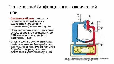 Инфекционно токсический шок инфекция