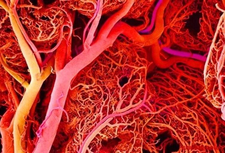 Нарушения кровеносных сосудов. Сосуды микроциркуляторного русла. Клетки кровеносных сосудов. Капилляры под микроскопом.