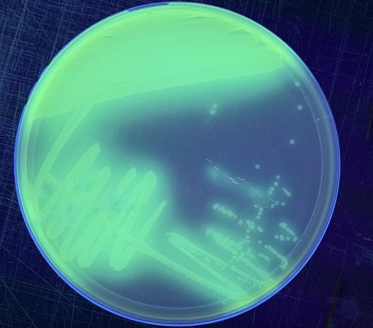 Pseudomonas spp что это. Пиоцианин pseudomonas aeruginosa. псевдомонас путида. pseudomonas aeruginosa микроскопия. pseudomonas putida под микроскопом.