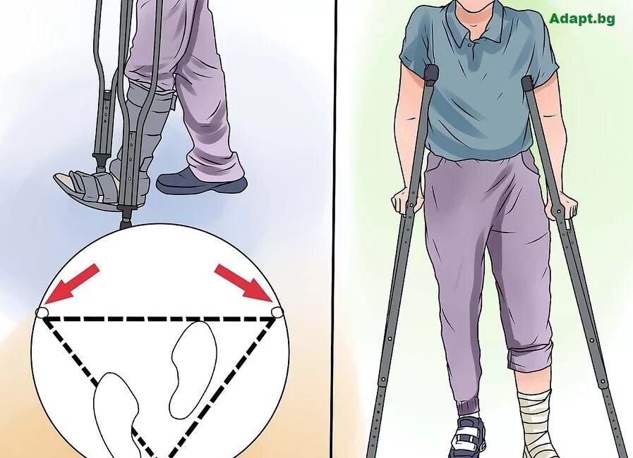 Трость после эндопротезирования. Ходьба на костылях. Правильная ходьба на костылях. Костыли для передвижения при переломе ноги. Передвижение на костылях.