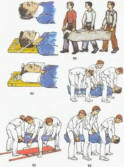 Транспортировка пациента при травме позвоночника алгоритм. Транспортировка при переломе позвоночника. Первая медпомощь при переломе позвоночника. ПМП перелом шейного отдела позвоночника.