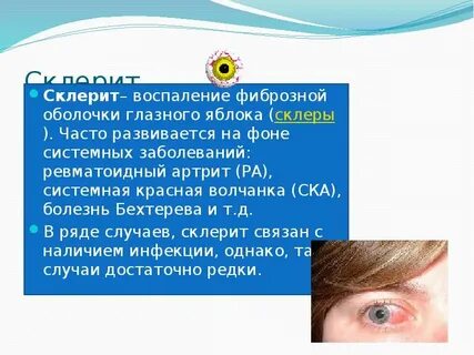 Болезнь глаз при болезни бехтерева