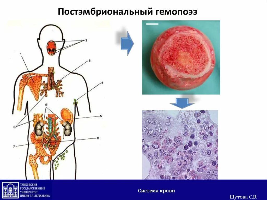 Постэмбриональный гемопоэз. Постэмбриональный гемопоэз гистология. Постэмбриональный гемоцитопоэз. Кроветворение. Эмбриональный постэмбриональный гемоцитопоэз.. Схема гемопоэза.