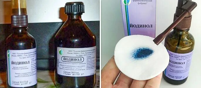 Можно ли мыть при ангине