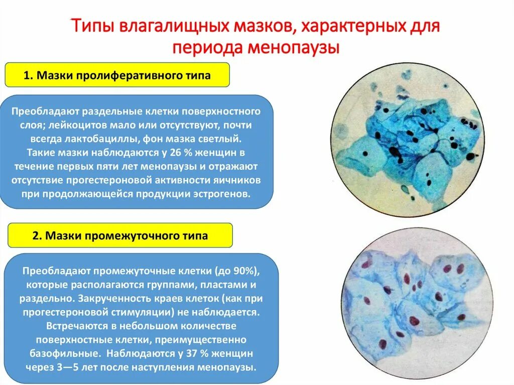 Плоский эпителий в цитограмме. Промежуточно клеточный Тип мазка что это такое. Гинекология атрофичный Тип мазка. Гипоэстрогенный Тип мазка. Цитологическое исследование влагалищных мазков.