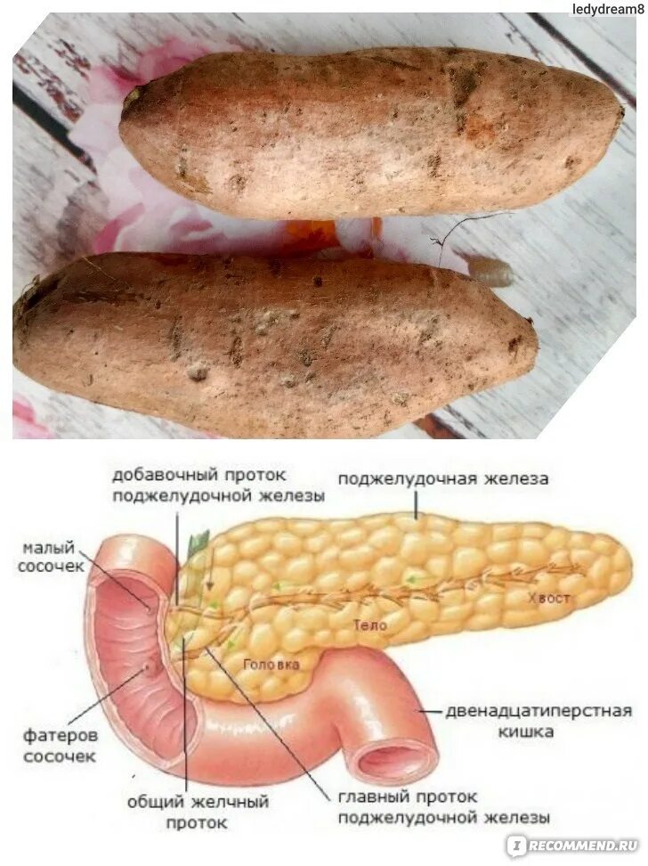 Сколько живут без поджелудочной железы