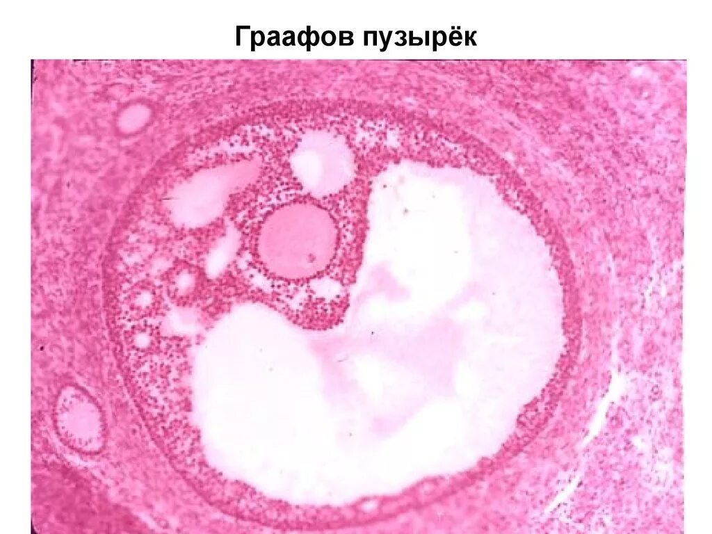 Граафов пузырек яичника. Граафов пузырек гистология. Граафов пузырек строение гистология. Третичный фолликул и граафов пузырёк. Зрелый фолликул граафов пузырек.