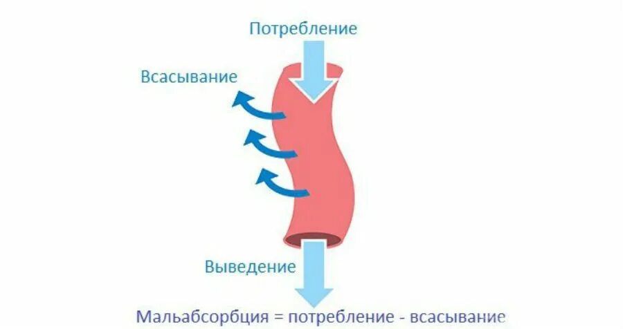 Синдром всасывания кишечника. Нарушение всасывания в кишечнике мальабсорбция. нарушение всасывания в кишечнике симптомы. наследственные синдромы нарушения всасывания в жкт. синдром мальабсорбции симптомы.