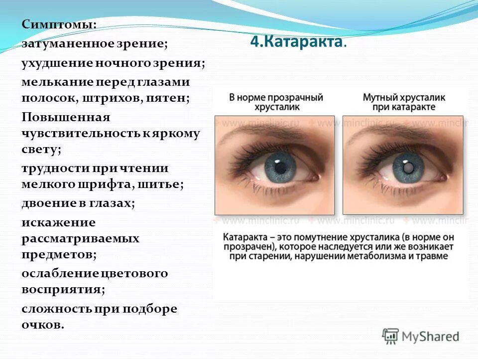 Симптомы ухудшения зрения. Признаки ухудшения зрения. Причины нарушения остроты зрения. Признаки падения зрения. Зрение глаза туман