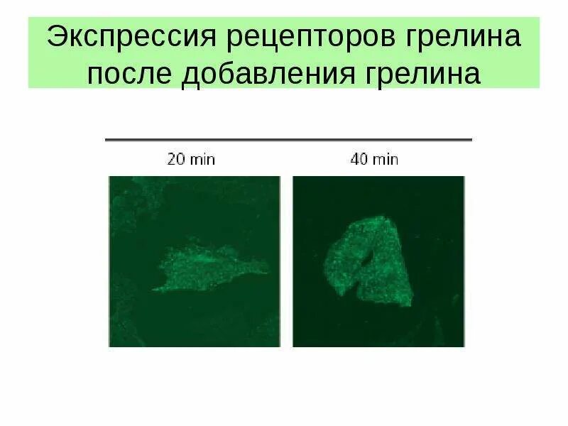 Экспрессия это определение. Экспрессионизм неоэкспрессионизм. Экспрессия 7. Экспрессия это в психологии. Экспрессия 7.
