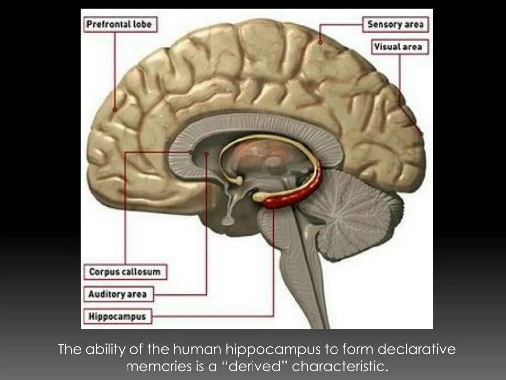 Большое полушарие мозолистое тело мост гипоталамус. Строение мозга человека гиппокамп. Аммонов Рог гиппокампа. Комиссура гиппокампа.