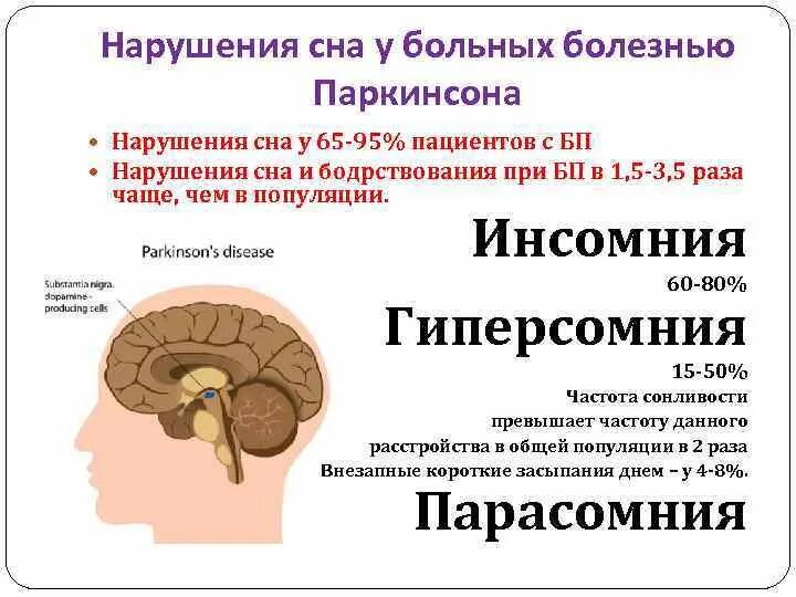 Болезни с нарушением сна. Нарушения сна неврология. Нарушение сна при паркинсонизме. Нарушение бодрствования неврология.