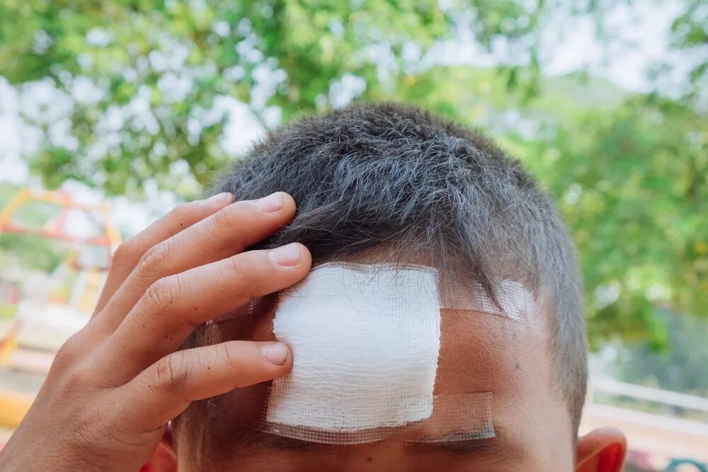 Признаки сотрясения мозга после удара. Глаза после сотрясение мозга. Симптомы при сотрясении мозга после удара головой. Признаками сотрясения или ушиба головного мозга являются. Признаки сотрясения головного мозга.