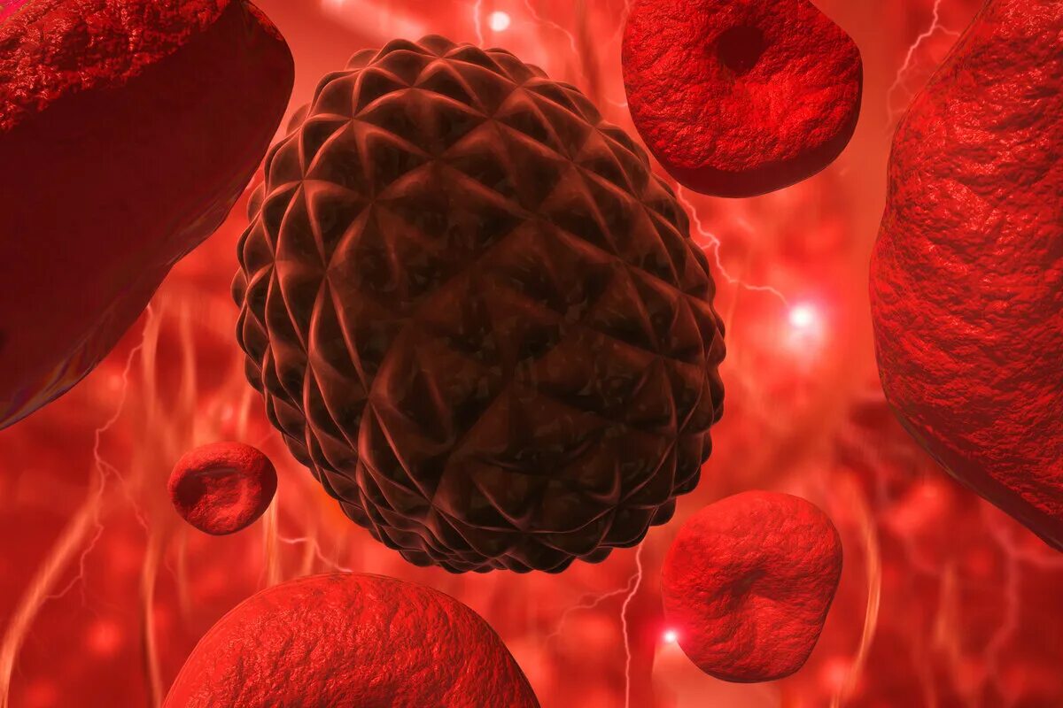 Leukemia